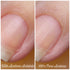 Acetone Antidote by Baroness X | Butterball