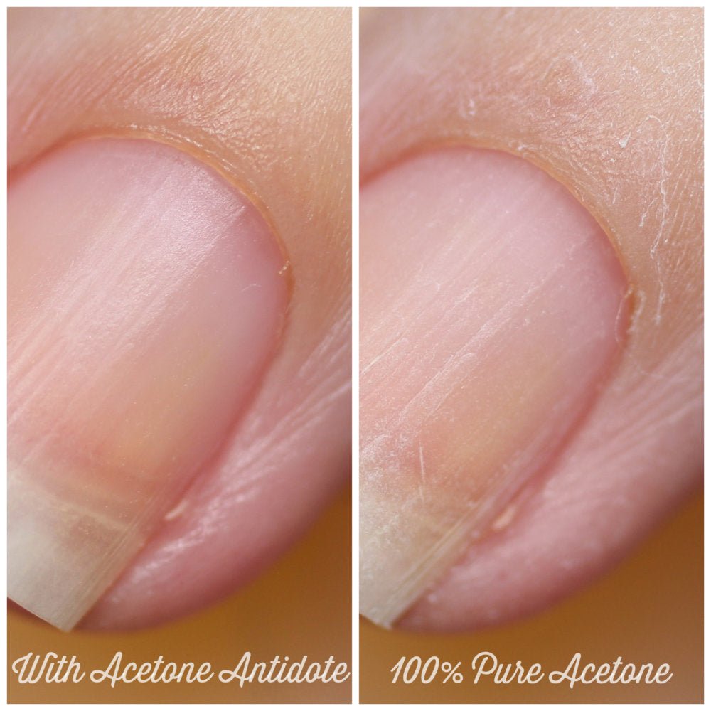 Acetone Antidote by Baroness X | Lemon Tartlet